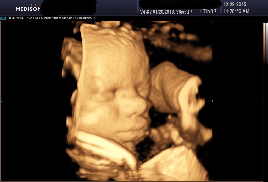 3d ultrasound photo printout