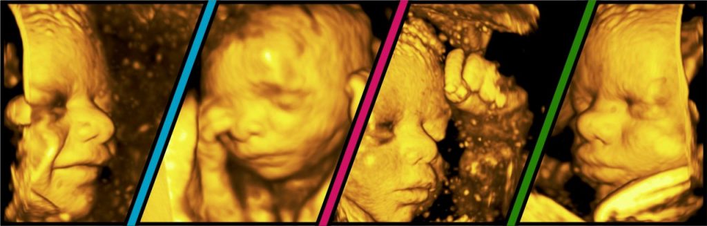 Baby in 3d Ultrasound studo in NY