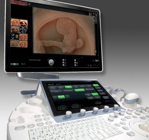 new ultrasound machine in NYC