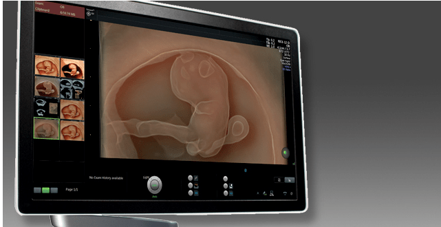 Ultrasound Sonogram Monitor at NYC clinic