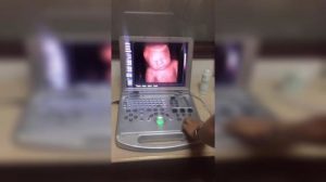 High Resolution 3D Ultrasound Technology