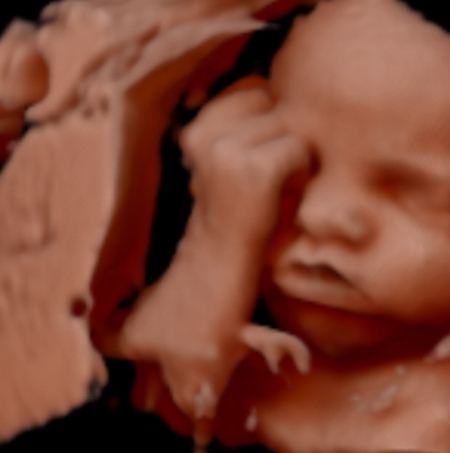 3D Ultrasound Scans Taken in Queens, NY