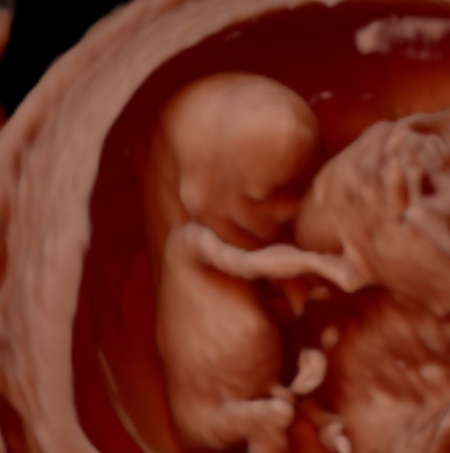 Baby Ultrasound Image in Queens, NYC office