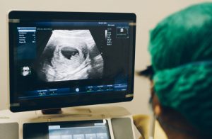 High End Ultrasound Machine in Queens, NY