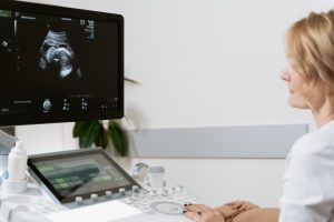 3D Ultrasound Machine sitting in Queens, NY